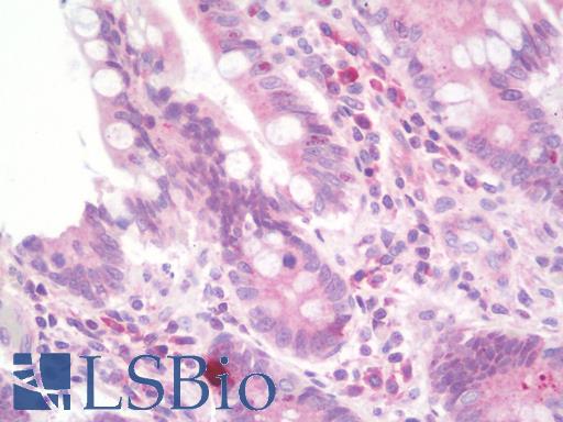 Anti-LEPR / Leptin Receptor antibody IHC staining of human small intestine. Immunohistochemistry of formalin-fixed, paraffin-embedded tissue after heat-induced antigen retrieval. Antibody LS-B10021 dilution 1:100.