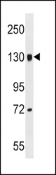 LEPR Antibody western blot of mouse brain tissue lysates (35 ug/lane). The LEPR antibody detected the LEPR protein (arrow).