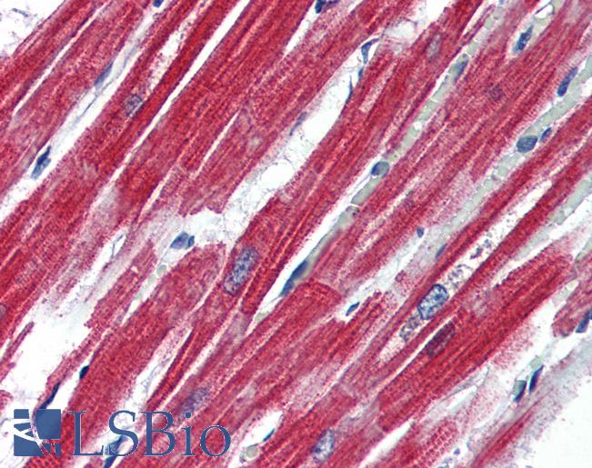 Anti-Leptin Receptor antibody IHC of human heart. Immunohistochemistry of formalin-fixed, paraffin-embedded tissue after heat-induced antigen retrieval. Antibody LS-B3013 concentration 4 ug/ml.