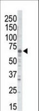Western blot of anti-GRK5 antibody in mouse brain tissue lysate. GRK5 (arrow) was detected using purified antibody. Secondary HRP-anti-rabbit was used for signal visualization with chemiluminescence.