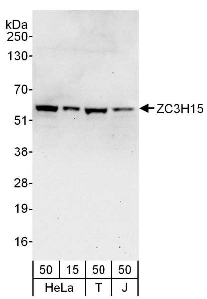 Detection of Human ZC3H15 by Western Blot. Samples: Whole cell lysate from HeLa (15 and 50 ug), 293T (T; 50 ug) and Jurkat (J; 50 ug) cells. Antibodies: Affinity purified rabbit anti-ZC3H15 antibody used for WB at 0.1 ug/ml. Detection: Chemiluminescence with an exposure time of 30 seconds.