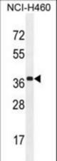 ZC3H15 Antibody western blot of NCI-H460 cell line lysates (35 ug/lane). The ZC3H15 antibody detected the ZC3H15 protein (arrow).