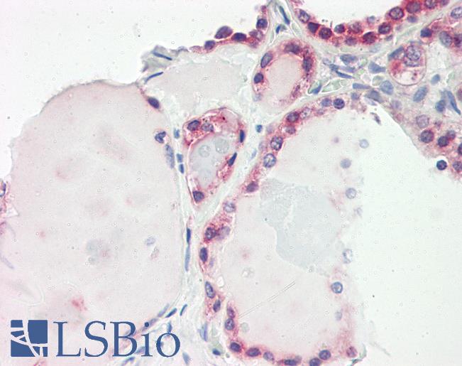 Anti-LEREPO4 / ZC3H15 antibody IHC of human thyroid. Immunohistochemistry of formalin-fixed, paraffin-embedded tissue after heat-induced antigen retrieval. Antibody LS-B8200 dilution 2.5-5 ug/ml.