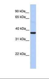 Fetal lung lysate. Antibody concentration: 1.0 ug/ml. Gel concentration: 12%.