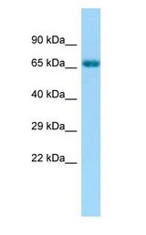 GRK6 antibody Western Blot of Fetal Bladder.
