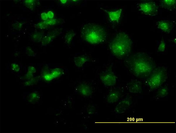 Immunofluorescence of monoclonal antibody to LFNG on HeLa cell. [antibody concentration 10 ug/ml]