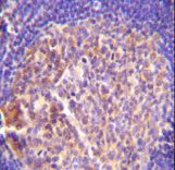 GRK6 Antibody immunohistochemistry of formalin-fixed and paraffin-embedded human tonsil tissue followed by peroxidase-conjugated secondary antibody and DAB staining.