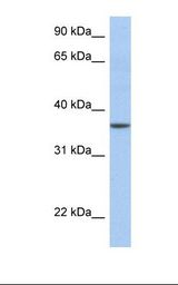 Fetal muscle lysate. Antibody concentration: 1.0 ug/ml. Gel concentration: 12%.