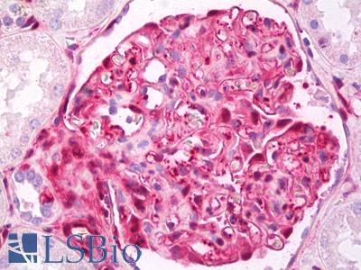 Anti-Galectin 1 antibody IHC of human kidney, glomeruli. Immunohistochemistry of formalin-fixed, paraffin-embedded tissue after heat-induced antigen retrieval. Antibody LS-B7736 dilution 5 ug/ml.