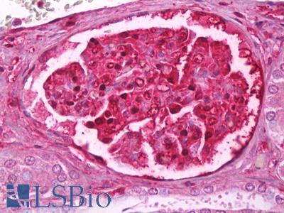 Anti-LGALS1 / Galectin 1 antibody IHC of human kidney, glomeruli. Immunohistochemistry of formalin-fixed, paraffin-embedded tissue after heat-induced antigen retrieval. Antibody LS-B6776 dilution 1:50.