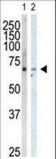 Western blot of anti-GRK6 antibody in HeLa cell lysate (Lane 1) and mouse heart tissue lysate (Lane 2). GRK6 (arrow) was detected using purified antibody. Secondary HRP-anti-rabbit was used for signal visualization with chemiluminescence.