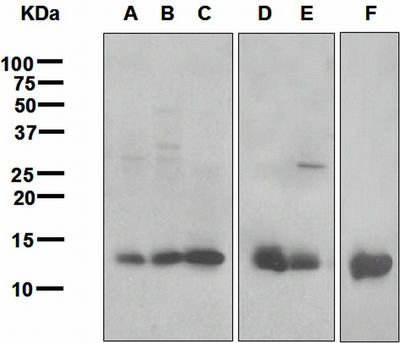 Western blot analysis on (A) mouse heart, (B) mouse kidney, (C) mouse spleen, (D) rat heart, (E) rat kidney, and (F) NIH/3T3 cell lysates using anti-Galectin-1 antibody.