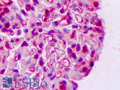 Anti-LGALS1 / Galectin 1 antibody IHC of human kidney, glomeruli. Immunohistochemistry of formalin-fixed, paraffin-embedded tissue after heat-induced antigen retrieval. Antibody LS-B7436 concentration 5 ug/ml.