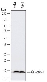 Detection of Human Galectin-1 by Western Blot. Western blot shows lysates of HeLa human cervical epithelial carcinoma cell line and A549 human lung carcinoma cell line. PVDF membrane was probed with 0.1 ug/ml of Goat Anti-Human Galectin-1 Antigen Affinity-purified Polyclonal Antibody followed by HRP-conjugated Anti-Goat IgG Secondary Antibody. A specific band was detected for Galectin-1 at approximately 14 kD (as indicated). This experiment was conducted under reducing conditions.