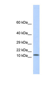 LGALS1 / Galectin 1 antibody LS-B6943 Western blot of Fetal Muscle lysate.