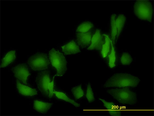 Immunofluorescence of monoclonal antibody to LGALS1 on HeLa cell. [antibody concentration 10 ug/ml]