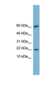 LGALS14 / Galectin 14 antibody LS-C110698 Western blot of Fetal Stomach lysate.