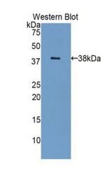 Western blot of recombinant LGALS8 / Galectin 8.