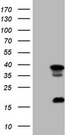 HEK293T cells were transfected with the pCMV6-ENTRY control (Left lane) or pCMV6-ENTRY LGALS9 (Right lane) cDNA for 48 hrs and lysed. Equivalent amounts of cell lysates (5 ug per lane) were separated by SDS-PAGE and immunoblotted with anti-LGALS9.