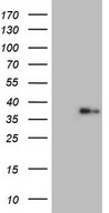 HEK293T cells were transfected with the pCMV6-ENTRY control (Left lane) or pCMV6-ENTRY LGALS9 (Right lane) cDNA for 48 hrs and lysed. Equivalent amounts of cell lysates (5 ug per lane) were separated by SDS-PAGE and immunoblotted with anti-LGALS9.