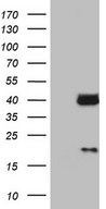 HEK293T cells were transfected with the pCMV6-ENTRY control (Left lane) or pCMV6-ENTRY LGALS9 (Right lane) cDNA for 48 hrs and lysed. Equivalent amounts of cell lysates (5 ug per lane) were separated by SDS-PAGE and immunoblotted with anti-LGALS9.