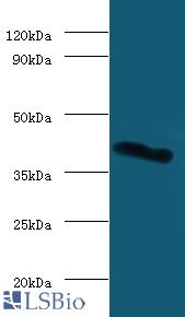 Western blot of Galectin-9 antibody at 2 ug/ml with mouse heart tissue Secondary Goat polyclonal to Rabbit IgG at 1:15000 dilution. Predicted band size: 40 KDa. Observed band size: 40 KDa.
