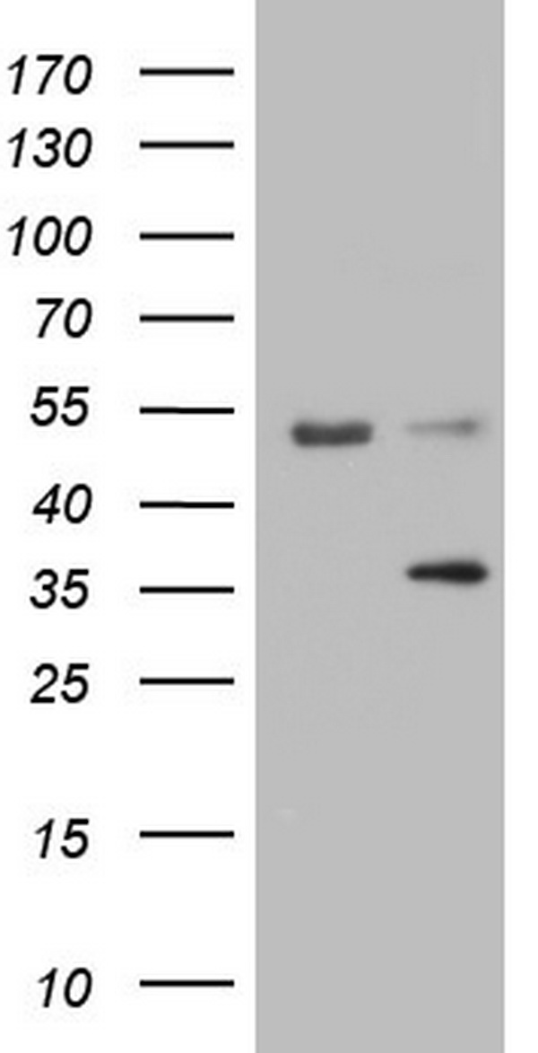 HEK293T cells were transfected with the pCMV6-ENTRY control (Left lane) or pCMV6-ENTRY LGALS9 (Right lane) cDNA for 48 hrs and lysed. Equivalent amounts of cell lysates (5 ug per lane) were separated by SDS-PAGE and immunoblotted with anti-LGALS9.