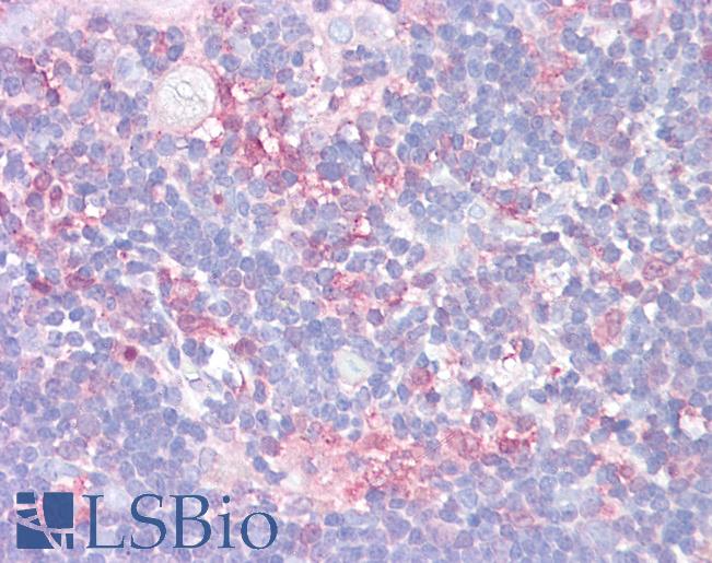 Anti-LGALS9 / Galectin-9 antibody IHC of human thymus. Immunohistochemistry of formalin-fixed, paraffin-embedded tissue after heat-induced antigen retrieval. Antibody LS-B6275 concentration 10 ug/ml.
