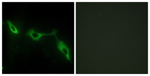 Immunofluorescence of NIH-3T3 cells, using LEG9 Antibody. The picture on the right is treated with the synthesized peptide.