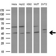 Western blot of extracts (10ug) from 5 different cell lines by using anti-LGALS9 monoclonal antibody at 1:200 dilution.