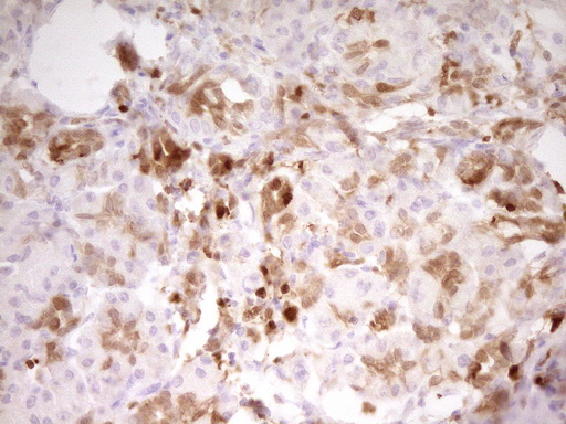 IHC of paraffin-embedded Human pancreas tissue using anti-LGALS9 mouse monoclonal antibody. (Heat-induced epitope retrieval by 1 mM EDTA in 10mM Tris, pH8.5, 120°C for 3min).