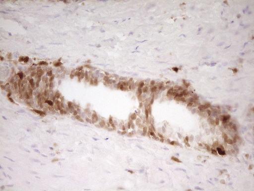 IHC of paraffin-embedded Human prostate tissue using anti-LGALS9 mouse monoclonal antibody. (Heat-induced epitope retrieval by 1 mM EDTA in 10mM Tris, pH8.5, 120°C for 3min).