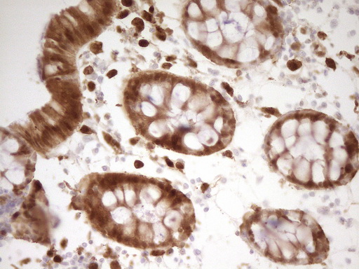 IHC of paraffin-embedded Human colon tissue using anti-LGALS9 mouse monoclonal antibody. (Heat-induced epitope retrieval by 1 mM EDTA in 10mM Tris, pH8.5, 120°C for 3min).