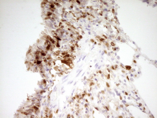 IHC of paraffin-embedded Human lung tissue using anti-LGALS9 mouse monoclonal antibody. (Heat-induced epitope retrieval by 1 mM EDTA in 10mM Tris, pH8.5, 120°C for 3min).