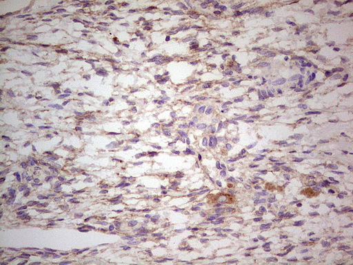 IHC of paraffin-embedded Human Ovary tissue using anti-LGALS9 mouse monoclonal antibody. (Heat-induced epitope retrieval by 1 mM EDTA in 10mM Tris, pH8.5, 120°C for 3min).