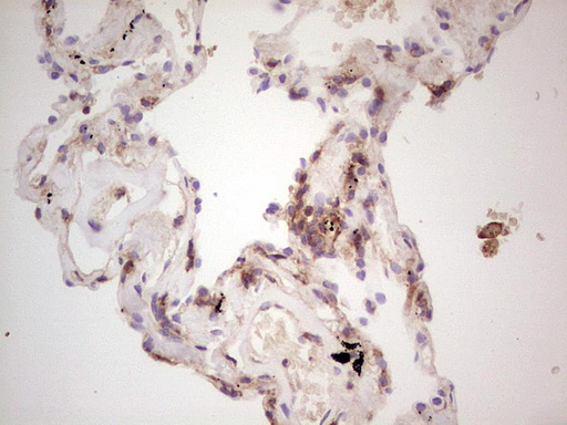 IHC of paraffin-embedded Human lung tissue using anti-LGALS9 mouse monoclonal antibody. (Heat-induced epitope retrieval by 1 mM EDTA in 10mM Tris, pH8.5, 120°C for 3min).