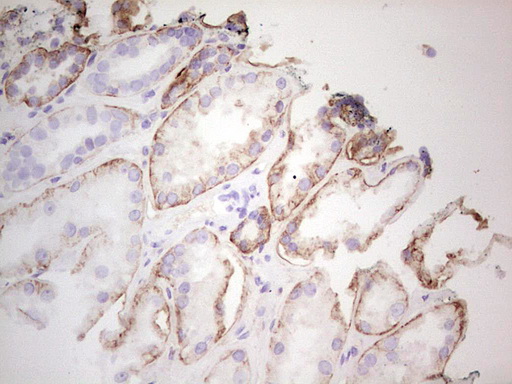 IHC of paraffin-embedded Human Kidney tissue using anti-LGALS9 mouse monoclonal antibody. (Heat-induced epitope retrieval by 1 mM EDTA in 10mM Tris, pH8.5, 120°C for 3min).