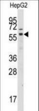 Western blot of anti-GRK7 Antibody in HepG2 cell line lysates (35 ug/lane). GRK7(arrow) was detected using the purified antibody.