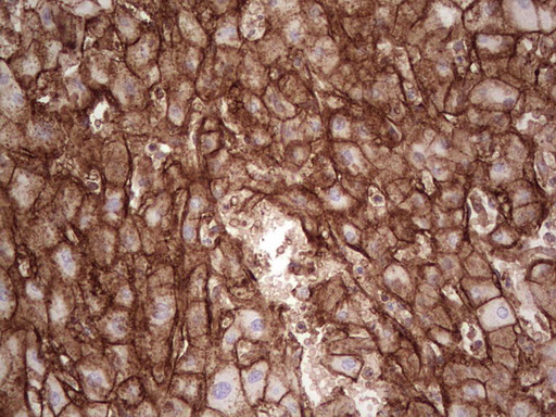 IHC of paraffin-embedded Human liver tissue using anti-LGALS9 mouse monoclonal antibody. (Heat-induced epitope retrieval by 1 mM EDTA in 10mM Tris, pH8.5, 120°C for 3min).