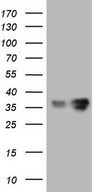 HEK293T cells were transfected with the pCMV6-ENTRY control (Left lane) or pCMV6-ENTRY LGALS9 (Right lane) cDNA for 48 hrs and lysed. Equivalent amounts of cell lysates (5 ug per lane) were separated by SDS-PAGE and immunoblotted with anti-LGALS9.