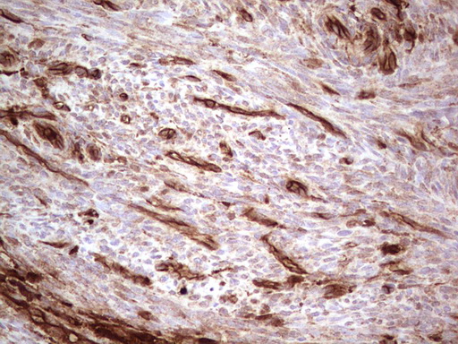IHC of paraffin-embedded Human endometrium tissue using anti-LGALS9 mouse monoclonal antibody. (Heat-induced epitope retrieval by 1 mM EDTA in 10mM Tris, pH8.5, 120°C for 3min).