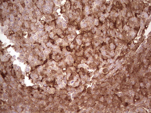 IHC of paraffin-embedded Human tonsil using anti-LGALS9 mouse monoclonal antibody. (Heat-induced epitope retrieval by 1 mM EDTA in 10mM Tris, pH8.5, 120°C for 3min).