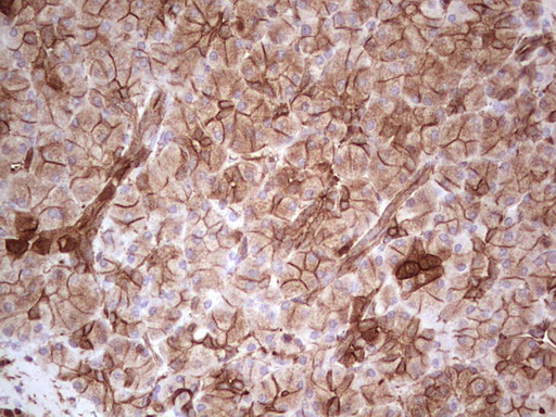 IHC of paraffin-embedded Human pancreas tissue using anti-LGALS9 mouse monoclonal antibody. (Heat-induced epitope retrieval by 1 mM EDTA in 10mM Tris, pH8.5, 120°C for 3min).