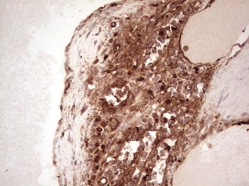IHC of paraffin-embedded Human lymph node tissue using anti-LGALS9 mouse monoclonal antibody. (Heat-induced epitope retrieval by 1 mM EDTA in 10mM Tris, pH8.5, 120°C for 3min).