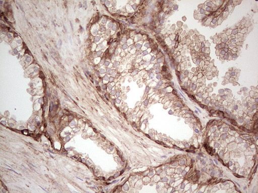 IHC of paraffin-embedded Human prostate tissue using anti-LGALS9 mouse monoclonal antibody. (Heat-induced epitope retrieval by 1 mM EDTA in 10mM Tris, pH8.5, 120°C for 3min).