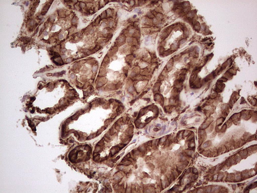 IHC of paraffin-embedded Human Kidney tissue using anti-LGALS9 mouse monoclonal antibody. (Heat-induced epitope retrieval by 1 mM EDTA in 10mM Tris, pH8.5, 120°C for 3min).