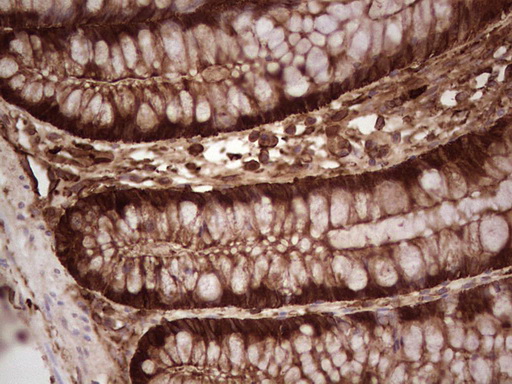 IHC of paraffin-embedded Human colon tissue using anti-LGALS9 mouse monoclonal antibody. (Heat-induced epitope retrieval by 1 mM EDTA in 10mM Tris, pH8.5, 120°C for 3min).