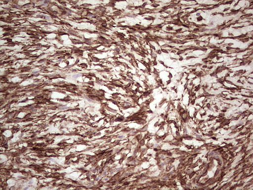 IHC of paraffin-embedded Human Ovary tissue using anti-LGALS9 mouse monoclonal antibody. (Heat-induced epitope retrieval by 1 mM EDTA in 10mM Tris, pH8.5, 120°C for 3min).