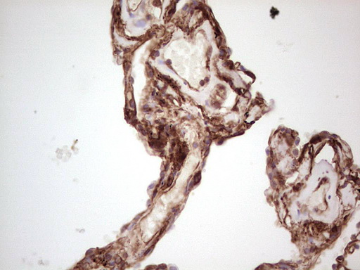 IHC of paraffin-embedded Human lung tissue using anti-LGALS9 mouse monoclonal antibody. (Heat-induced epitope retrieval by 1 mM EDTA in 10mM Tris, pH8.5, 120°C for 3min).