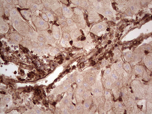 IHC of paraffin-embedded Human liver tissue using anti-LGALS9 mouse monoclonal antibody. (Heat-induced epitope retrieval by 1 mM EDTA in 10mM Tris, pH8.5, 120°C for 3min).